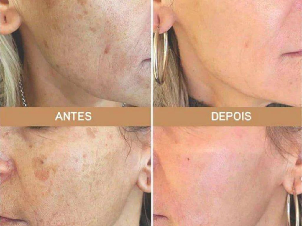 Rosa Amazônica em Promoção - Compre Online e Receba em Ajapi.
